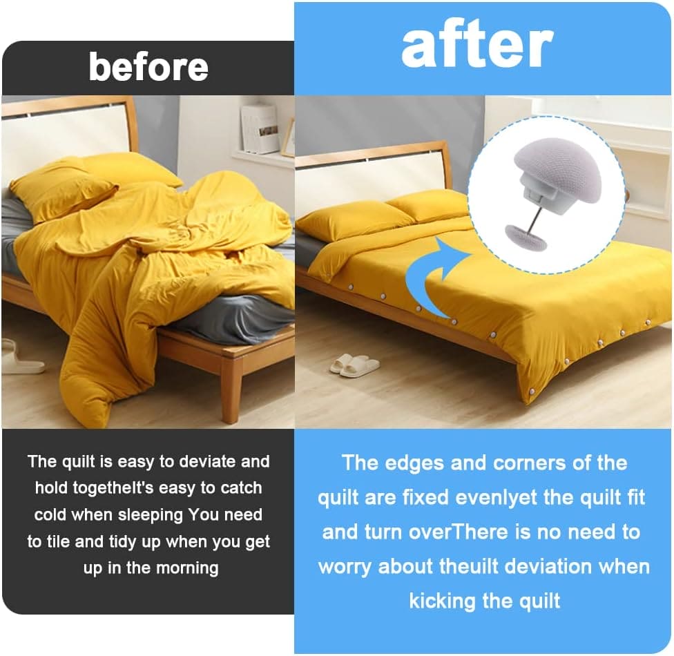 Mushroom Bed Clip, Blanket Buckles Bed Sheet Fixator Gripper, Double Press Bedspread Holder, Fall-proof Sheet Fastener Clip, Comforter Clips Quilt Holder Fixator, Bedroom Duvet Fixing Holder Quilt Cover Pinso Mushroom Bed Clip, Blanket Buckles Bed Sheet Fixator Gripper, Double Press Bedspread Holder, Fall-proof Sheet Fastener Clip, Comforter Clips Quilt Holder Fixator, Bedroom Duvet Fixing Holder Quilt Cover Pinso